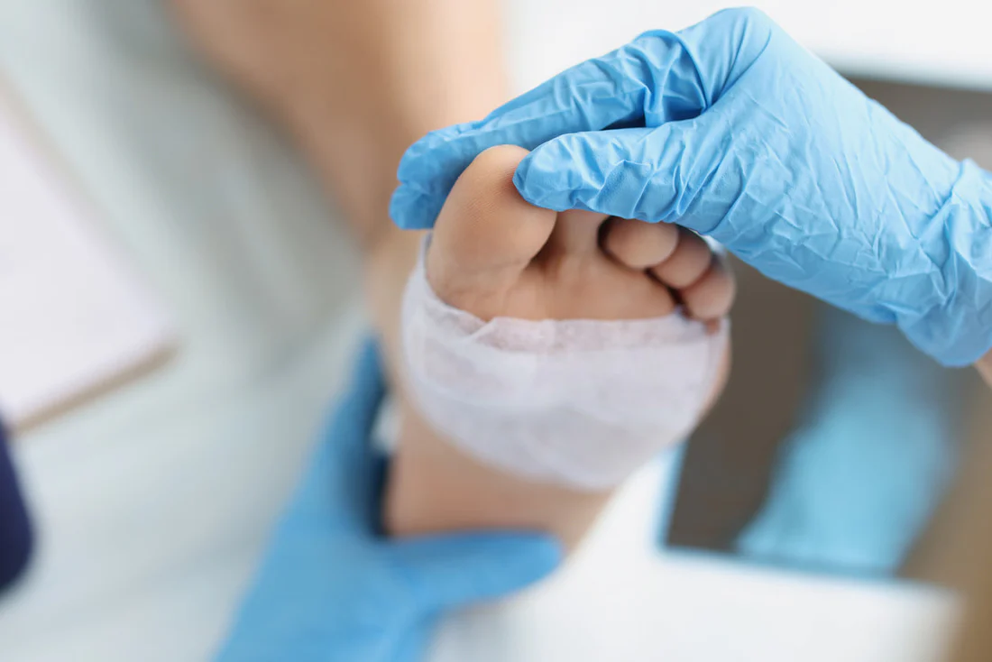 Effective Strategies for Managing Diabetic Wounds