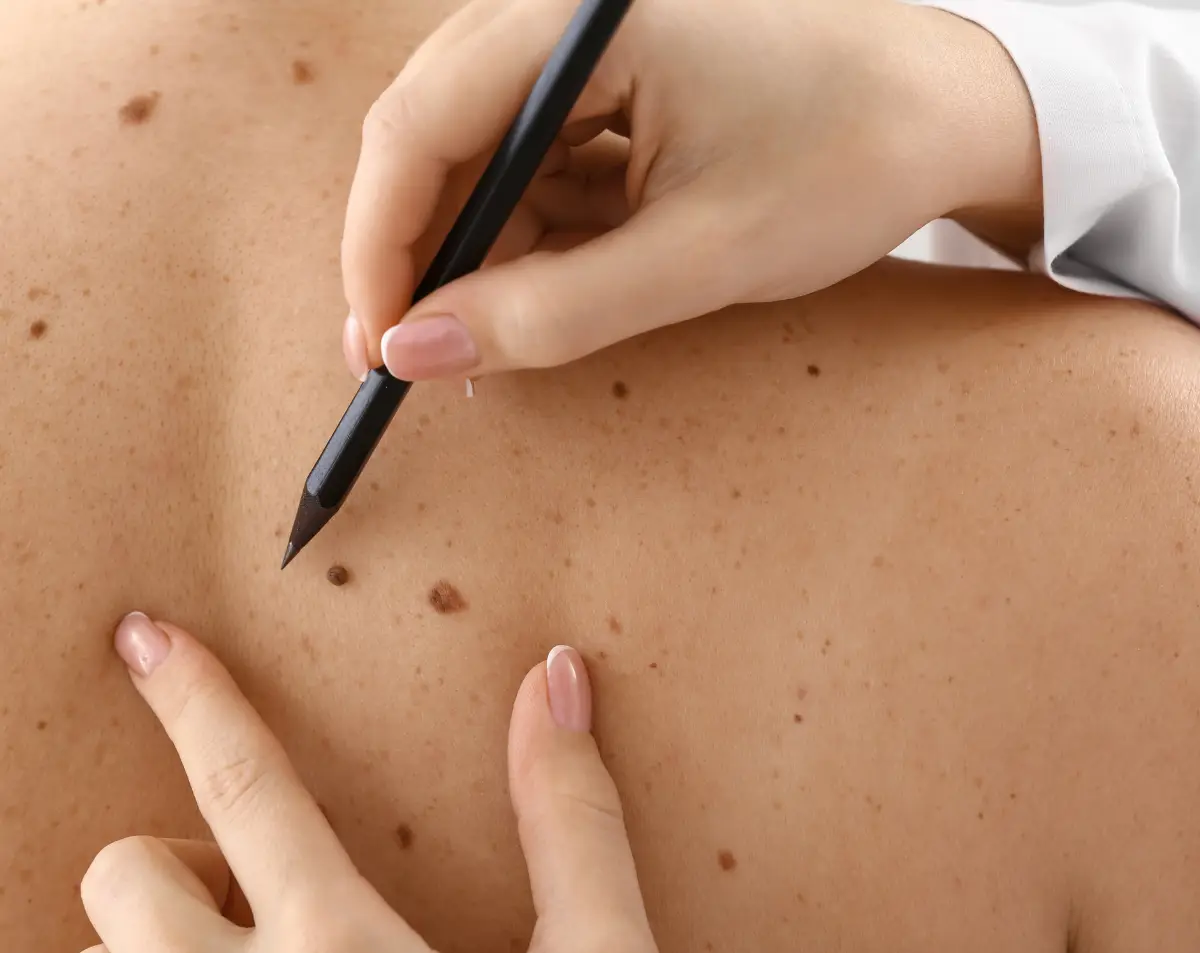 How Dermatologists Use Technology in Skin Cancer Detection