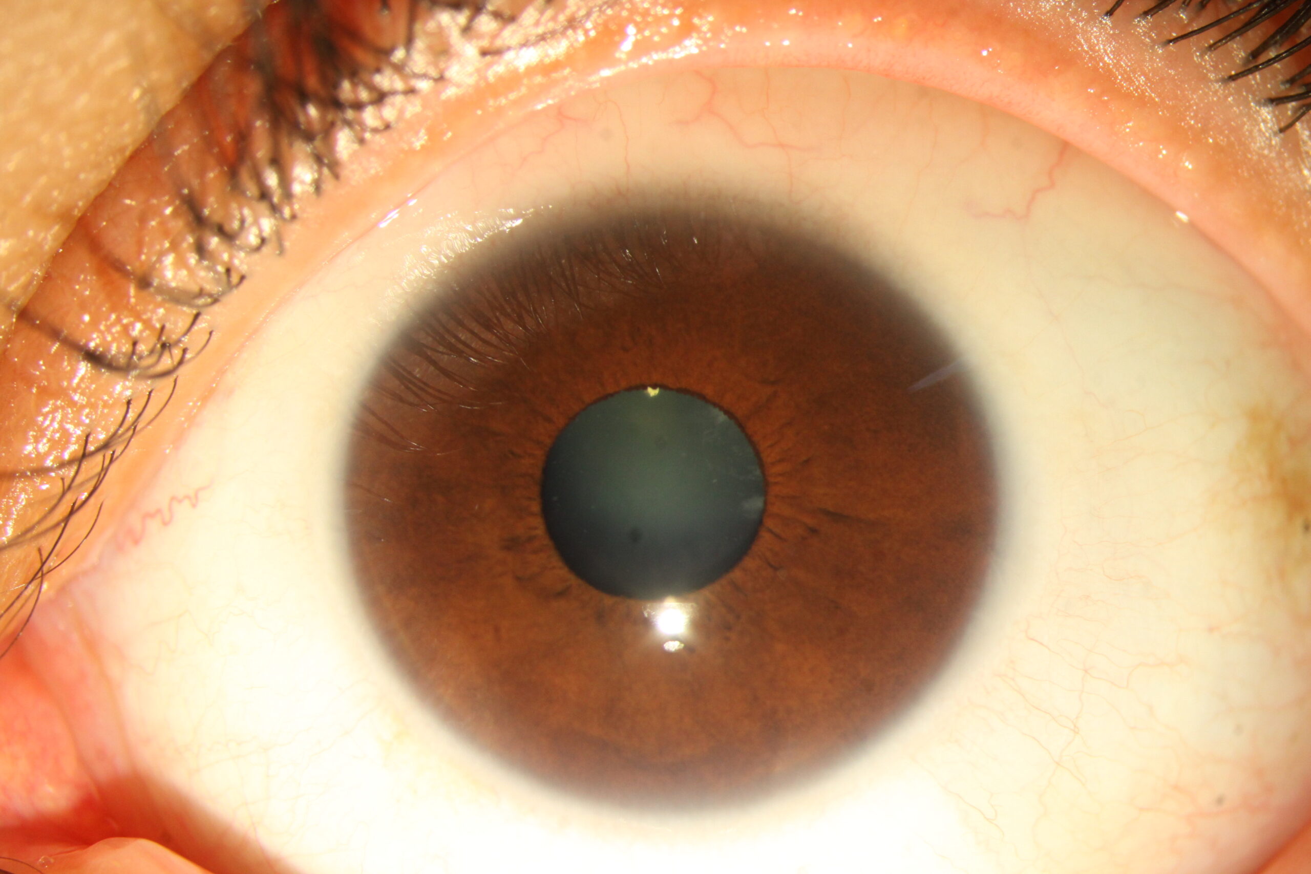 How Iridology Can Reveal Insights Into Your Health