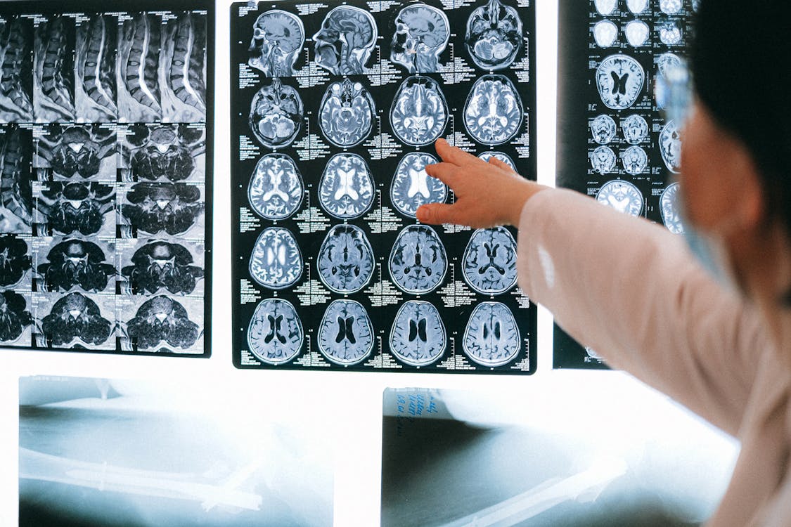 How Neurologists Utilize Advanced Imaging Techniques for Diagnosis