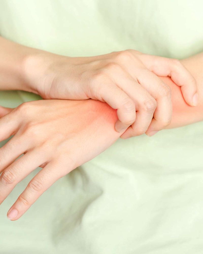 How an Orthopedic Specialist Diagnoses Carpal Tunnel