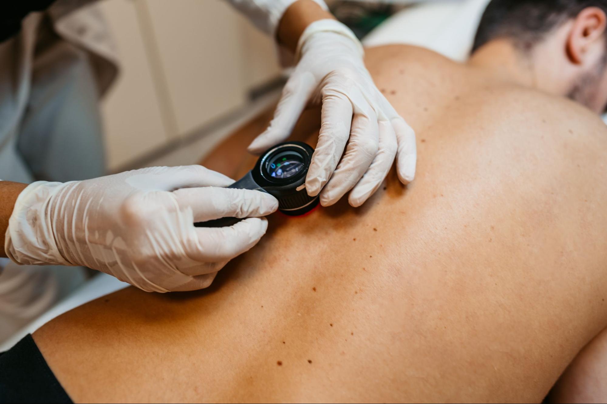 Post-Operative Care After Mohs Surgery
