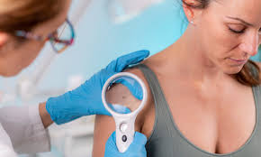 The Role of General Dermatology in Skin Cancer Prevention