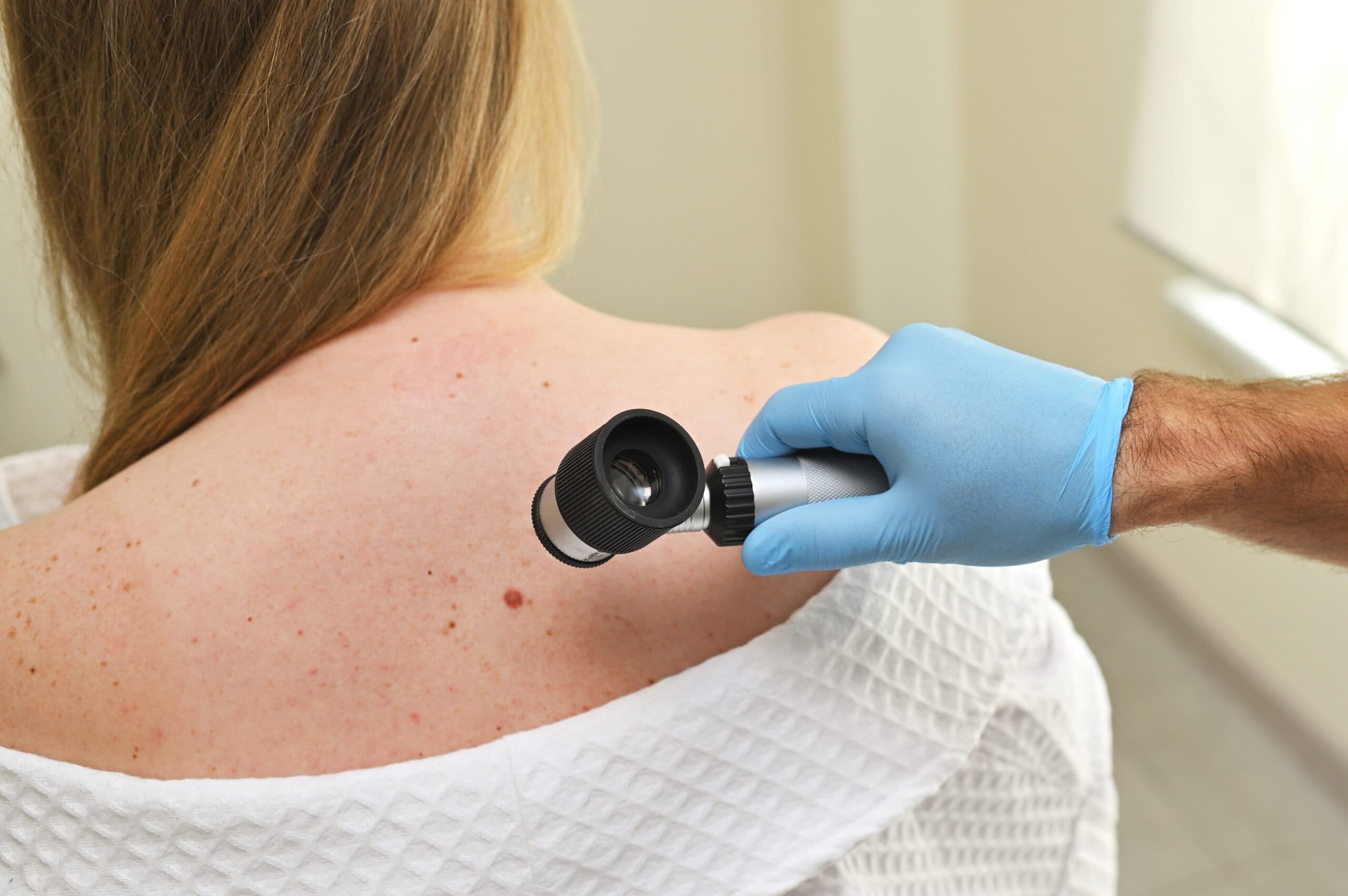 The Role of Mohs Surgery in Treating Non-Melanoma Skin Cancers