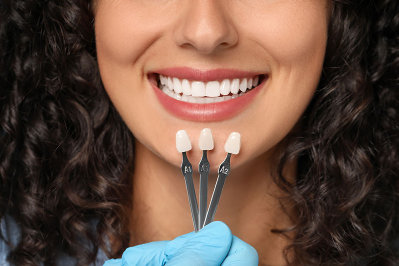 The Versatility of Veneers in Cosmetic Dentistry