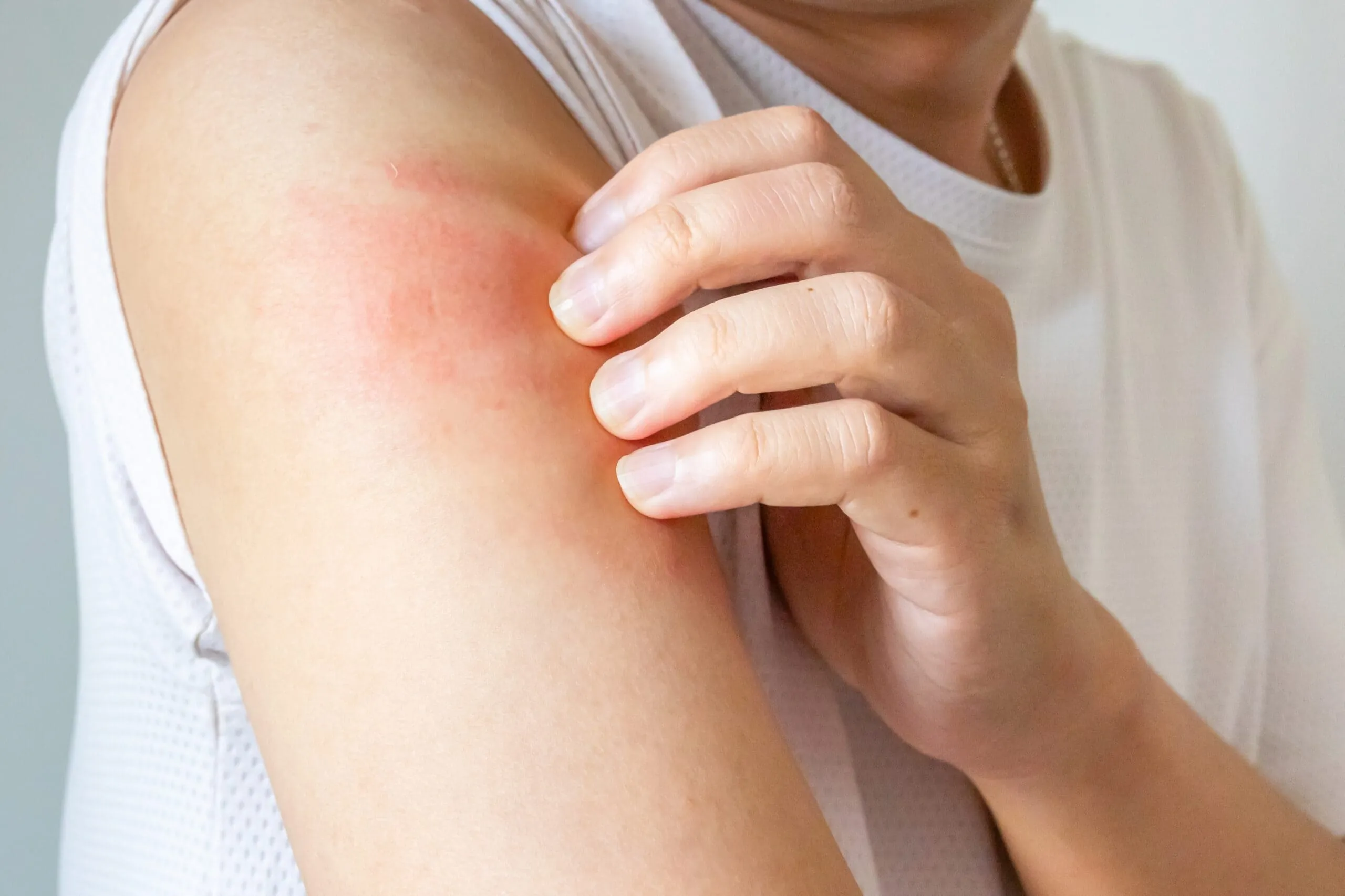 Understanding Dermatological Conditions