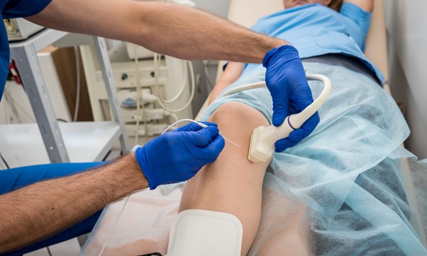 Understanding When To Consult a Vascular Surgeon
