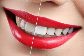 What Can a Cosmetic Dentist Do for Me?