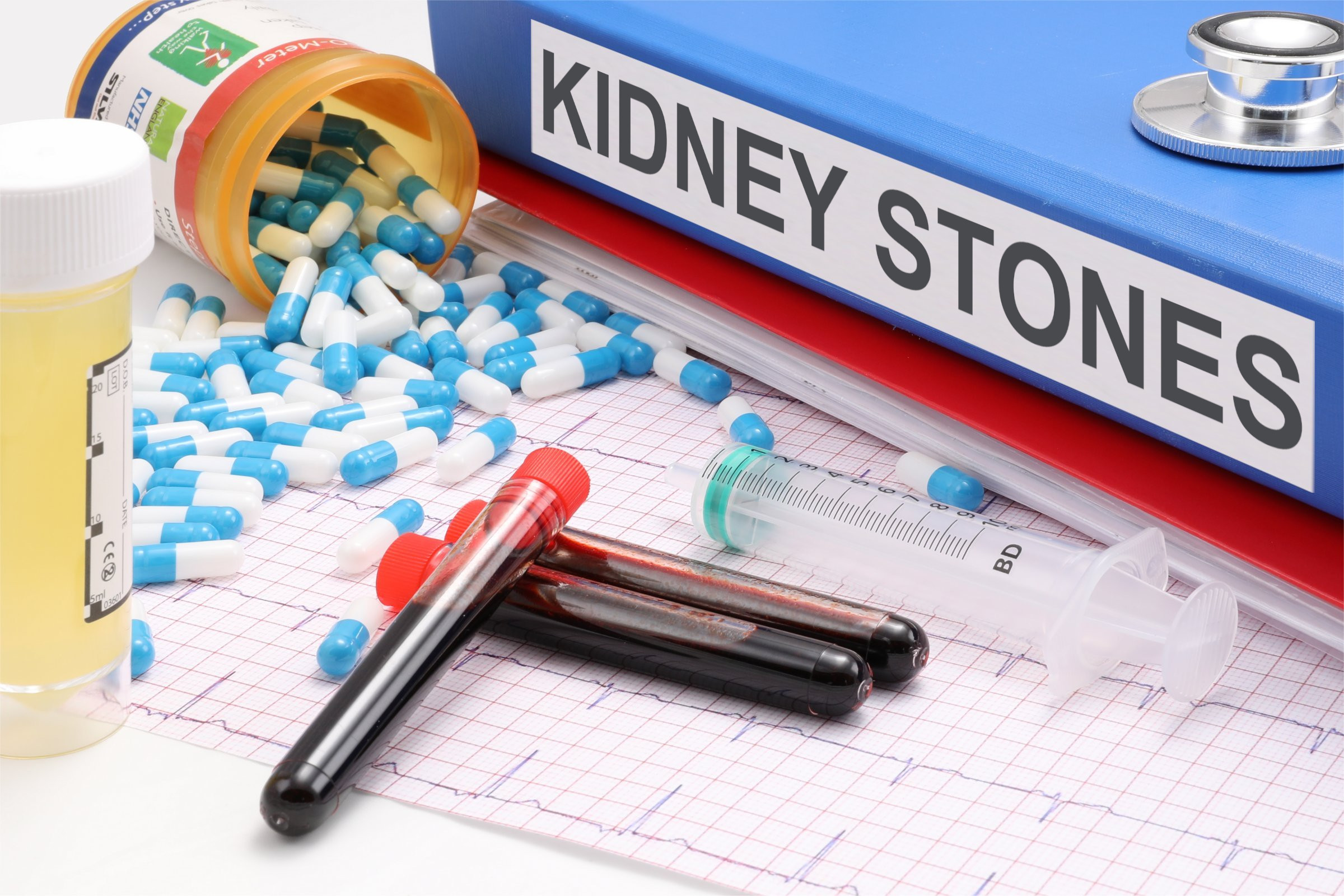 What To Expect During an Examination for Kidney Stones