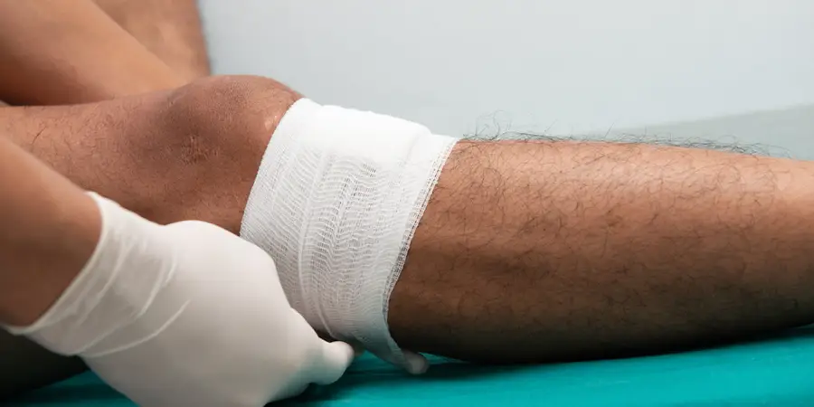 Addressing Venous Ulcers With Help From a Specialist