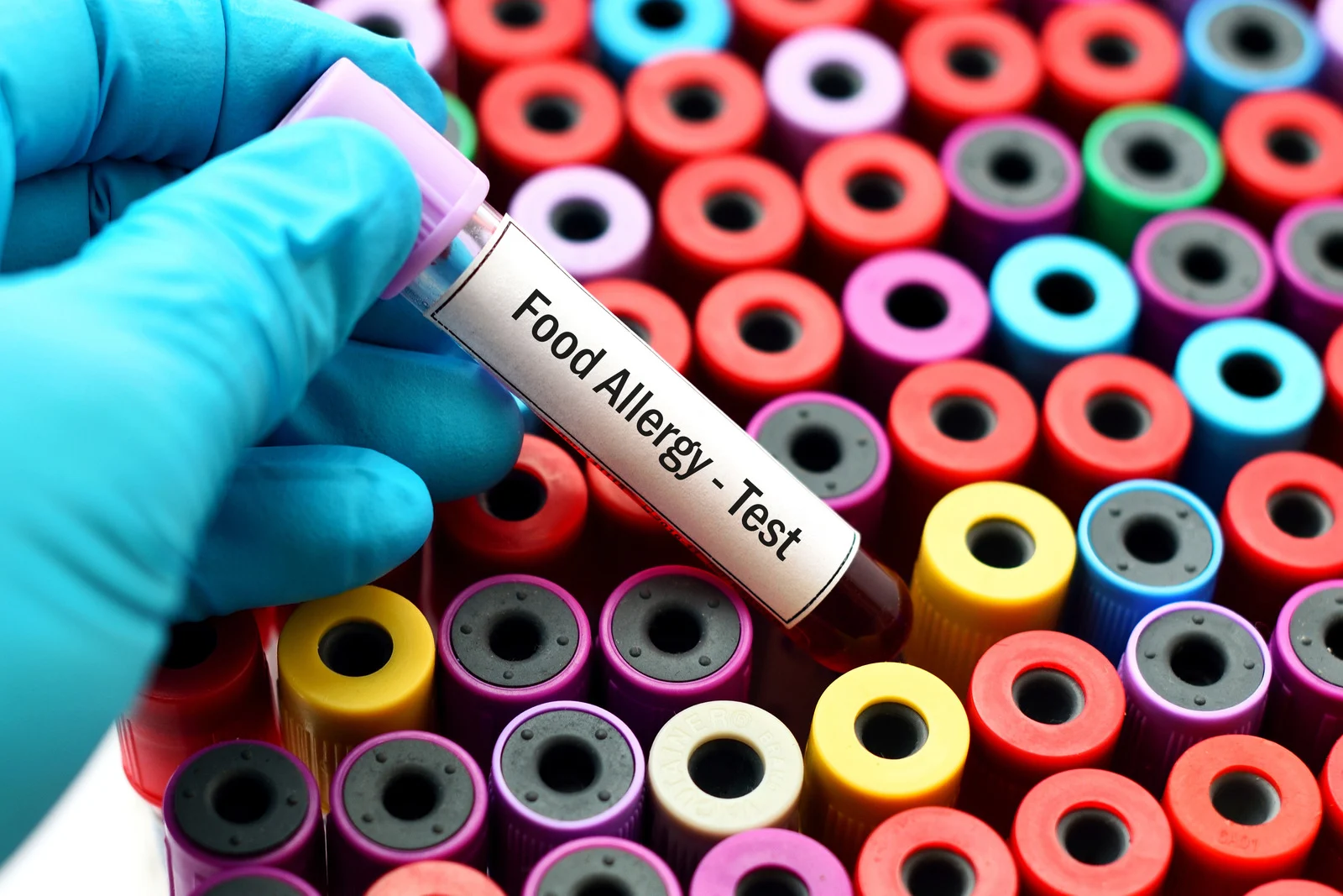 How Allergy Testing Can Help You Find Relief