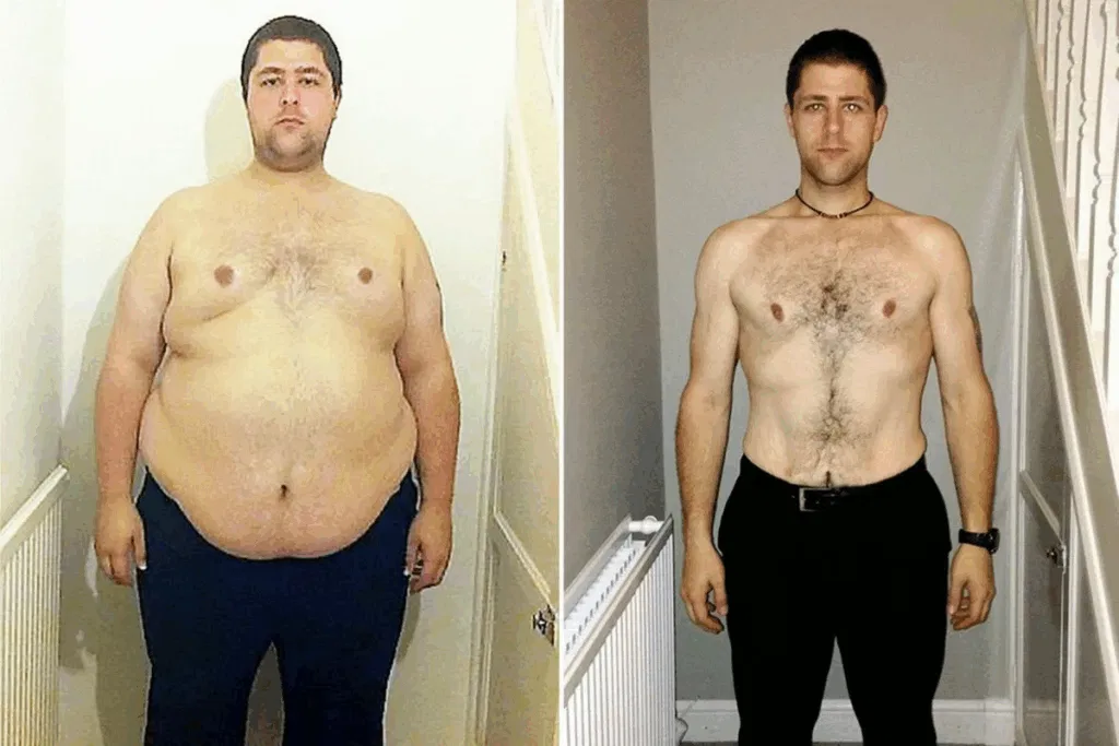 How To Determine if You Need a Bariatric Surgeon