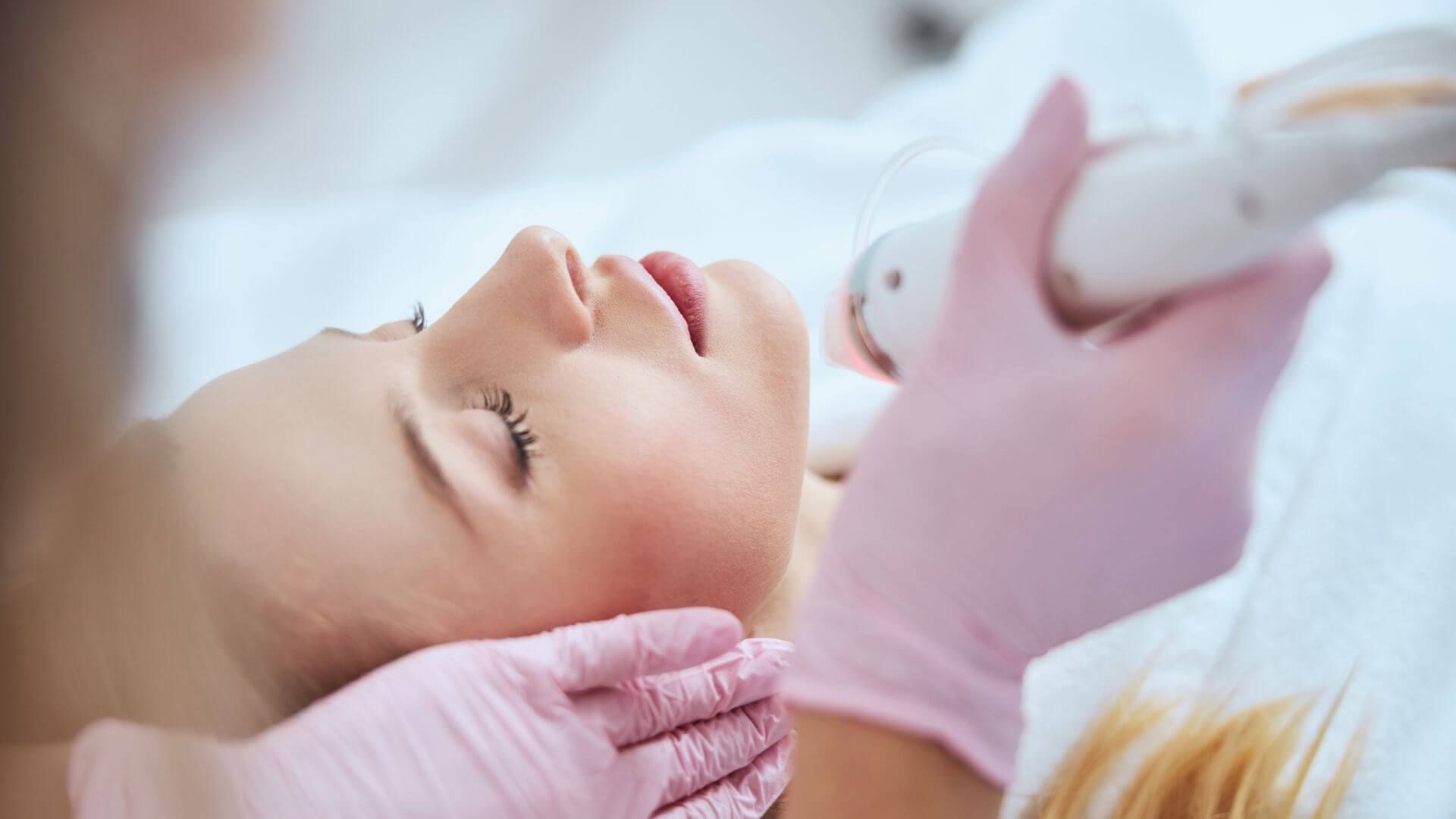 Is Microneedling or Chemical Peels Right for you?