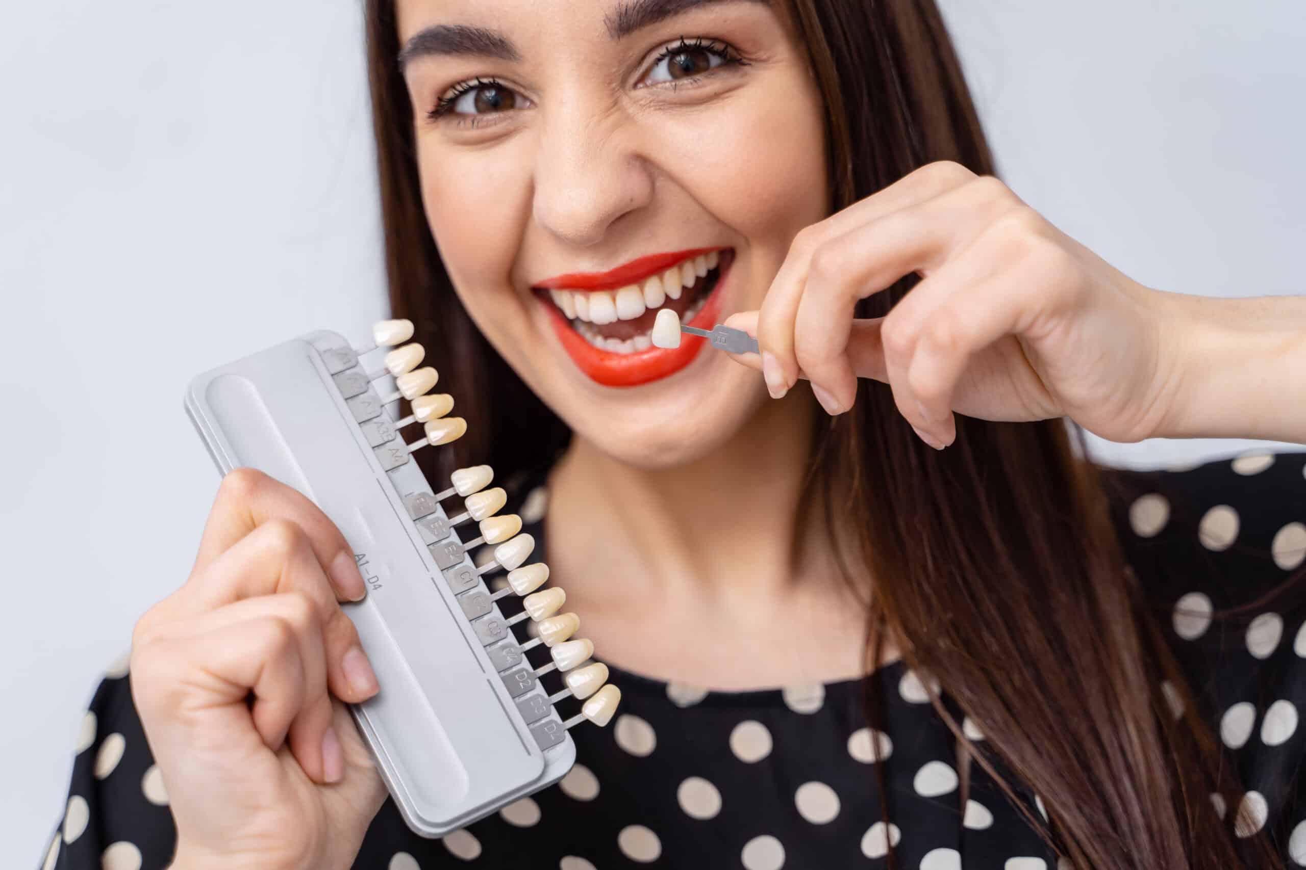 Maintaining a Natural Look With Veneers
