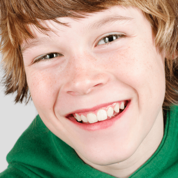 What Parents Need to Know About Invisalign for Teens