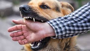 What to Do When You or a Pet Is Bitten by an Animal