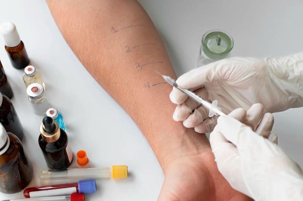 What to Expect During Allergy Testing