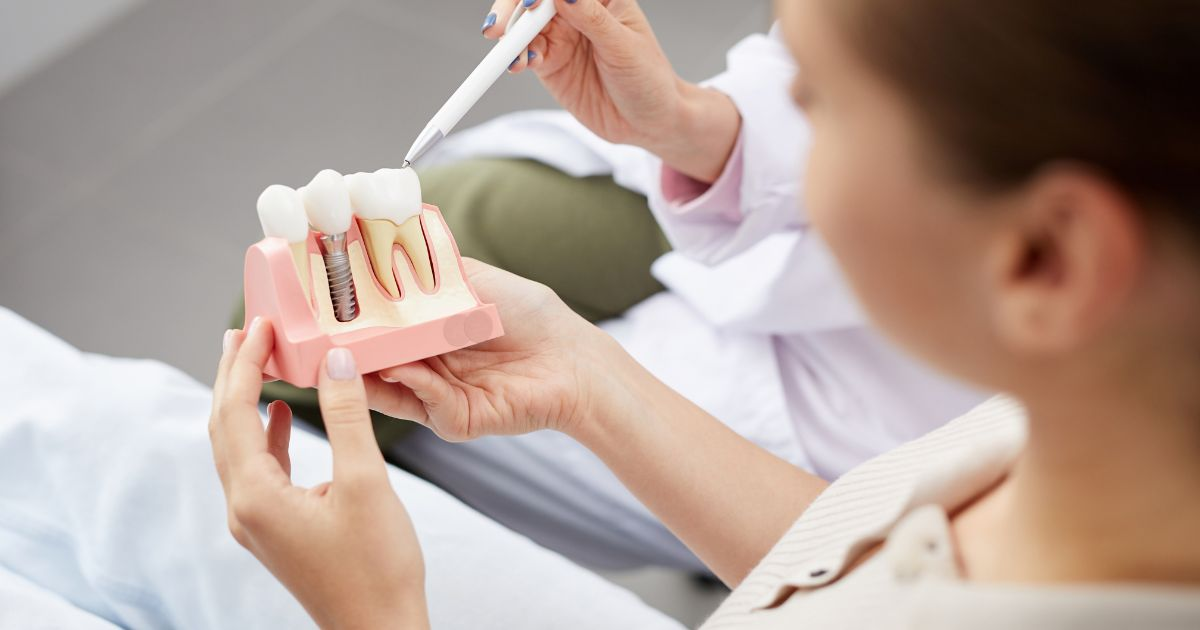 Dental Implant Consultation and Treatment: A Complete Guide to Restoring Your Smile